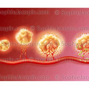 MÉDICAMENTS ANTI-ANGIOGÉNIQUES