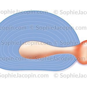 HERNIE DISCALE